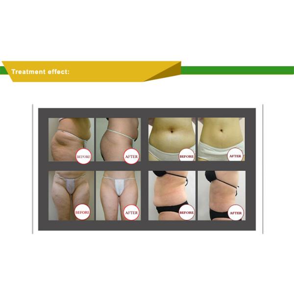 Vela кавитации ролика 40k вакуума формируют машину для тела тонкого