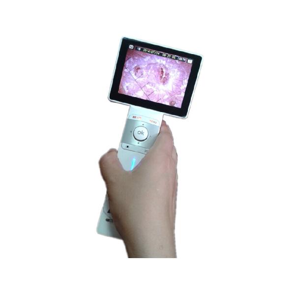 Dérmatoscope vidéo numérique 1920x1080