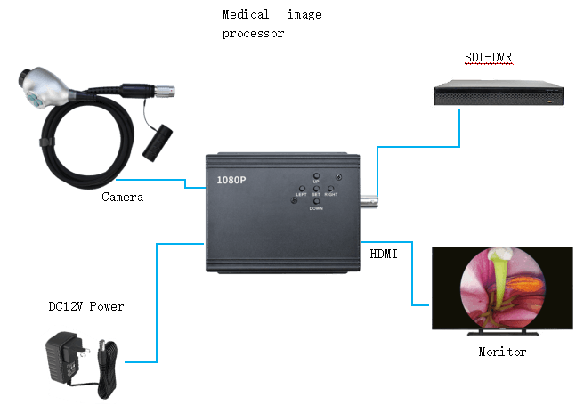 LN-23YL_2M Endoscope Camera | 1080P 60FPS Portable Image Processor