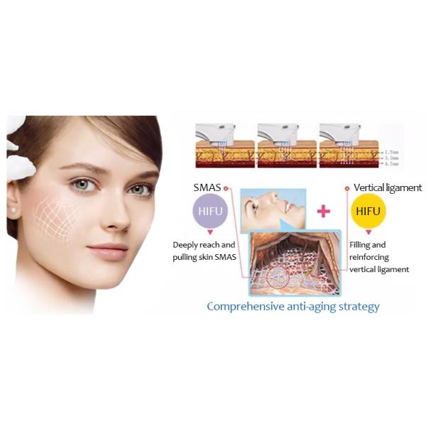 Высокая интенсивность сфокусировала тело машины ультразвука ультразвука ХИФУ/ХИФУ уменьшая машину