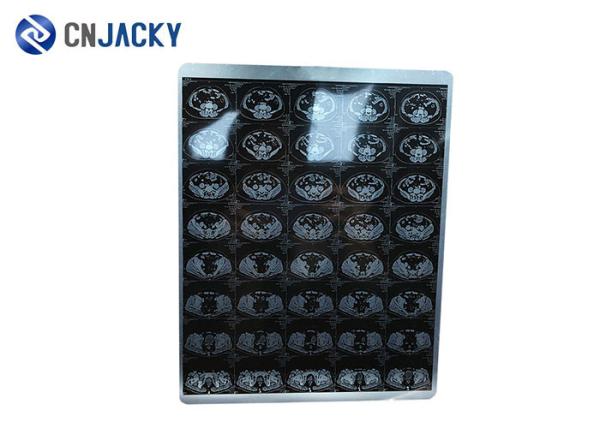 100 Sheet / Pack X Ray 44m Medical Radiation Printing Film