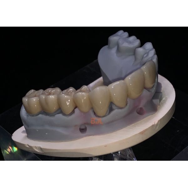 Custom fit Ceramic Dental Prosthetics featuring excellent strength natural look and performance in restorative dental applications