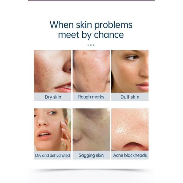 6 в 1 оборудовании салона ухода за лицом Hydrodermabrasion машины красоты гидры очищая