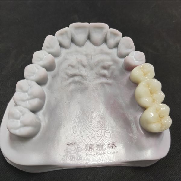 Customized Specification Denture Products Zirconia Ceramic Crowns and Bridge with Fast Turnaround Time CE FDA Certified