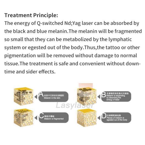 3 IN 1 Q Switch Picosecond YAG Laser Machine High Frequency