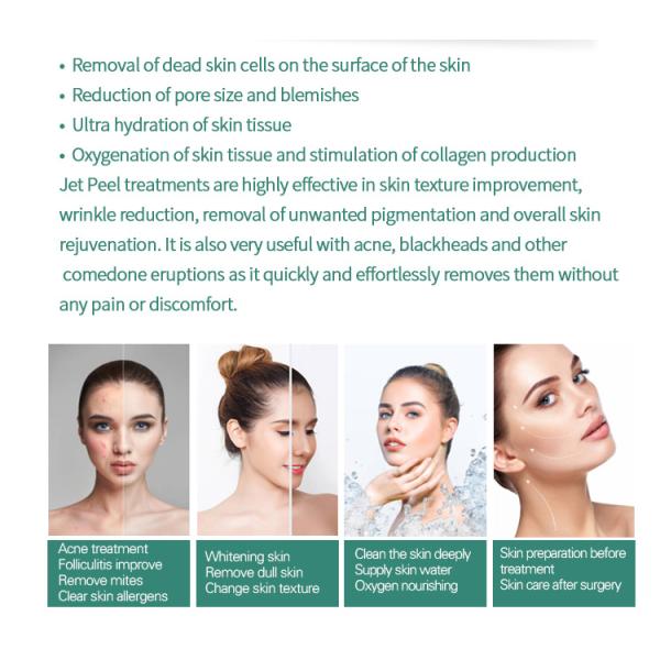 Oxígeno no invasor Jet Machine Skin Tightening de 110V 240V