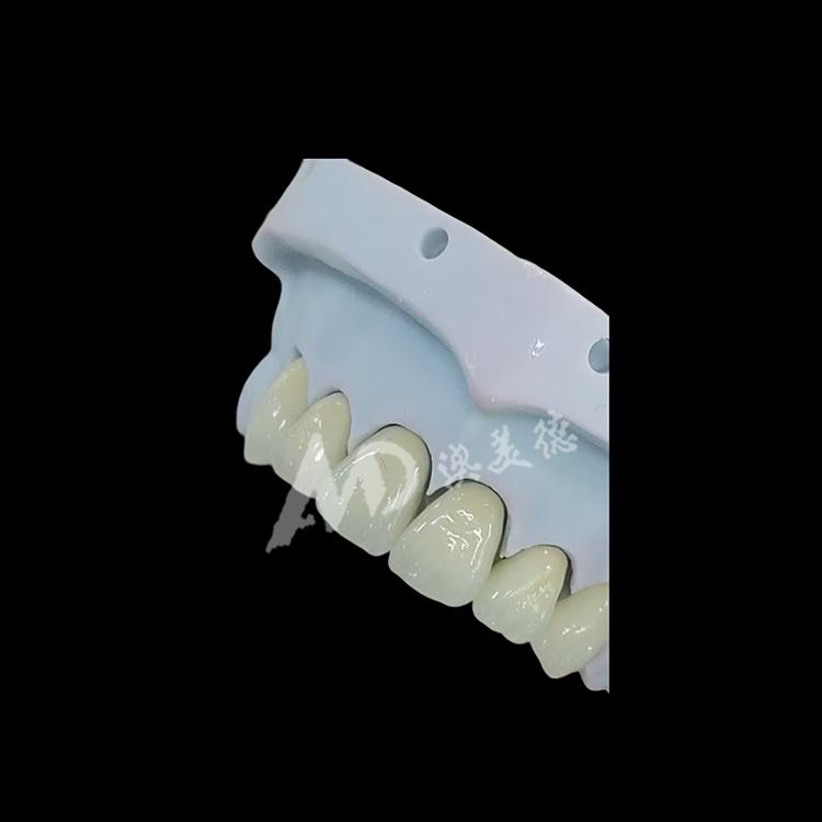 Full Contour Monolithic Zirconia Dental Crown
