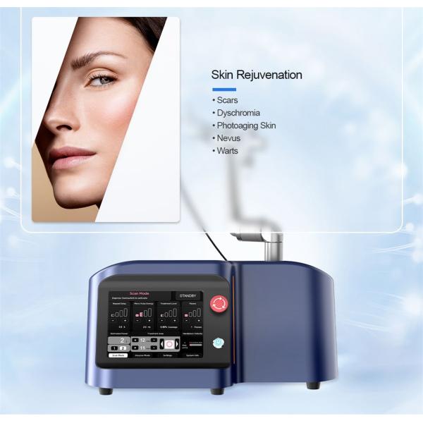 Машина лазера Laser/Co2 самого нового СО2 Protable частичная хирургическая медицинская