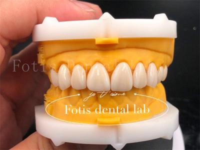 Fast And Efficient Digital Dental Crowns Size Customization Tooth Implant Crown