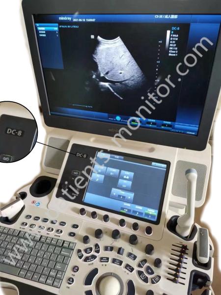 マインドレイDC-8超音波機器 ACR-NEMA DICOM 3.0 標準医療超音波機器