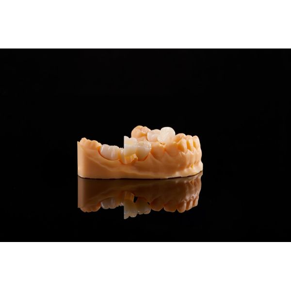 Multilayer Zirconia Blocks Dental Gradient for CAD CAM Crown Bridge
