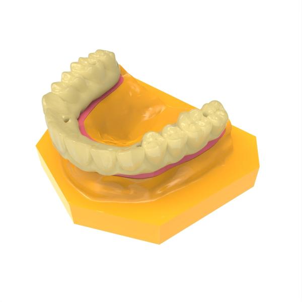 Résine photosensible pour pont dentaire