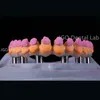 Titanium Abutment Dental Implant Screw Retained Crown 3D Laser Printing Customized
