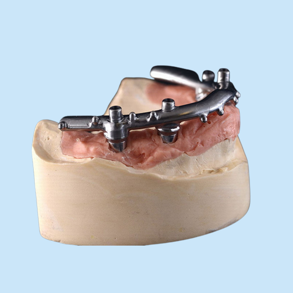 Твердость Dentures зубных имплантатов высокой плотности PFM сильная продолжительная