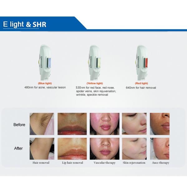 Skin Rejuvenation Permanent Laser Hair Removal Ipl Hair Removal Machine