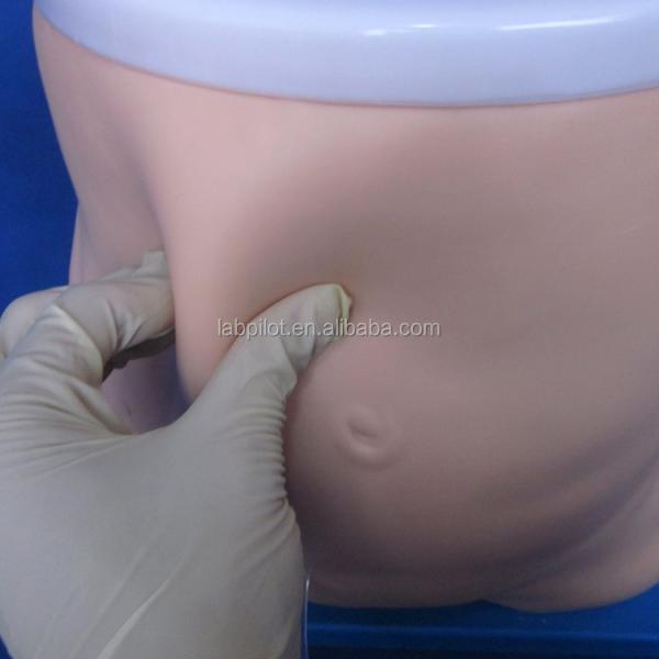 Peritoneal Dialysis Teaching Model Clinical Nursing Training and Performance Tool