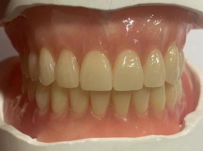 Customizable Full Denture Acrylic Teeth High Stability For Dentistry Use