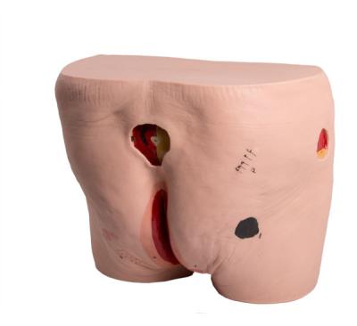 Pressure Decubitus Ulcers Care Bedsores Nursing Manikin