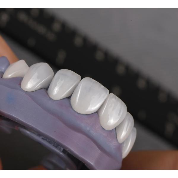 Естественный вид Emax Veneers Crown Biocompatibility Bleaching Shade с минимальной подготовкой