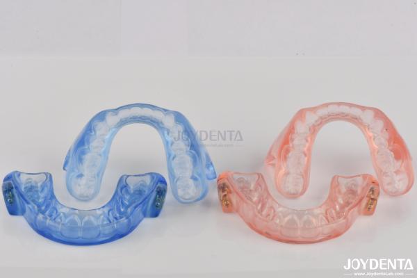 Custom Fitting Sleeping Aid Mouthpieces Dental Appliance To Stop Snoring