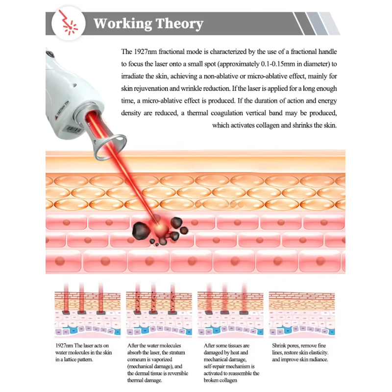 Portable New 1927nm Thulium Laser for Melasma Laser 1927 Thulium Micro Ablative 1927 Non Ablative Laser Thulium Facial Laser
