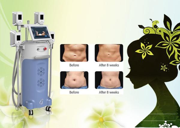 4  big handles Great weight loss-15 ~5Celsuis degree machine cryolipolysis