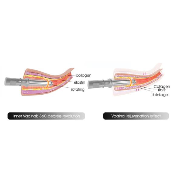 кожа лазера СО2 машина/50В красоты лазера 10600нм частичная Ресурфасинг