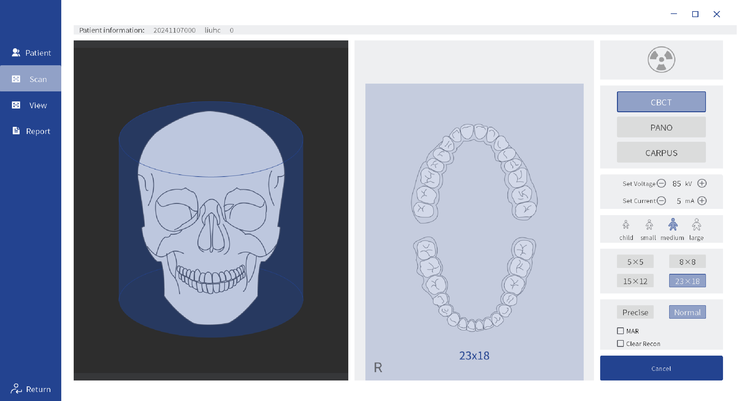 Dental Implant Orthodontic CBCT System High-Resolution 3D Imaging for Precise Diagnosis