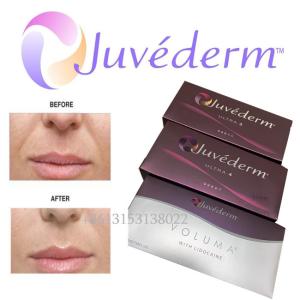Впрыска лицевого заполнителя продолжительная Ultra3 Ultra4 Voluma Juvederm Hyaluronic кисловочная
