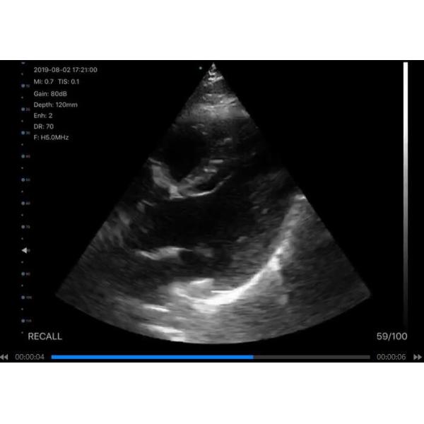 Cuerpo linear cardiaco 3 del PDA de Digitaces del ultrasonido del escáner de la conexión inalámbrica de Wifi EN 1 radio que carga 6 idiomas