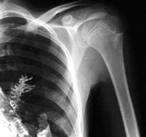 Filme de Fuji X Ray da impressora térmica de Konida, filme de Agfa Drystar Dt2b
