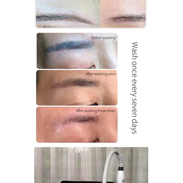 La peau Pico Carbon Facial Laser Machine tatouent le retrait 1064nm 532nm 1320nm