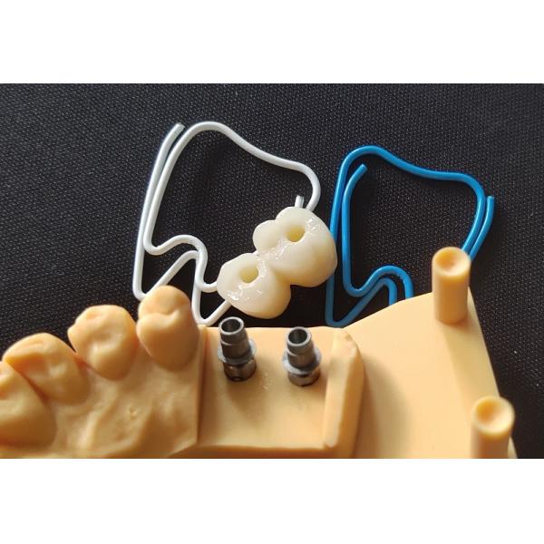 Natural ASC Angled Screw Channel Dental Implants Crown