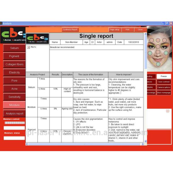 Hot!!! CE qualified best quality boxy skin and hair analyzer