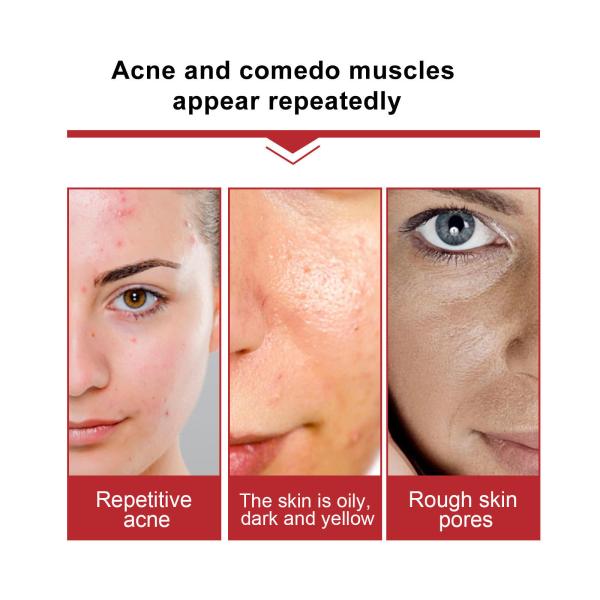 Moisturizing Repairing Face Serum Soothing Face Serum Complex Fruit Acid Essence