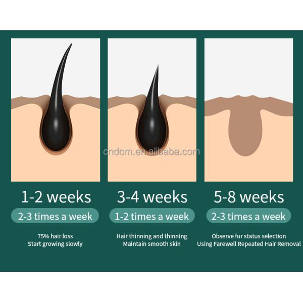 Home Facial Hair Removal Painless Hair Remover Machine for Women and Men Private Mold