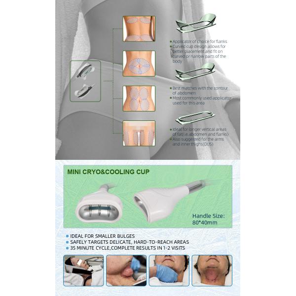 360 Cryo Vacuum RF Lipo Laser 6 en 1 Grasa congelación de pérdida de peso máquina de adelgazamiento corporal