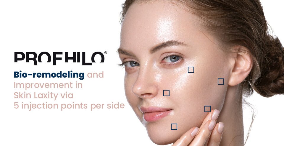 Profhilo h l Hyaluronic кисловочная дермальная впрыска горловины для заполнения подтяжка лица 5 пунктов