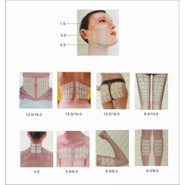 Plus de massage facial et de corps de congélation de machine des tirs 3D HIFU se soulevant formant la machine