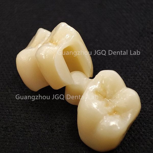 Long Lasting Zirconia Crown Bridge Precise Margin Adaptation for Dental Restoration