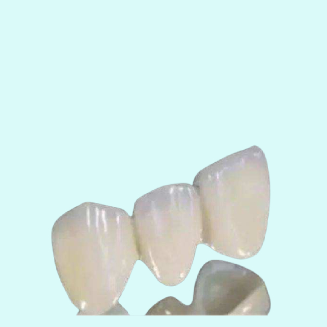 Технология CAD CAM твердости зубоврачебных зубов Denture Zirconia лаборатории высокая
