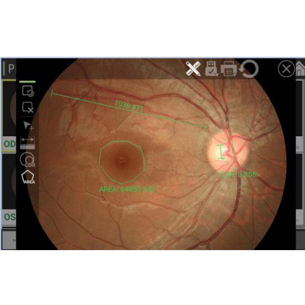 Ретинальное отображая режима зрачка камеры Fundus цифров разрешение небольшого высокое