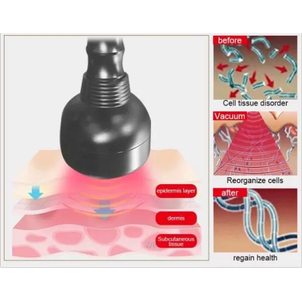 Portable 75W Black Color Body Massager Cavitation Vacuum Slimming Weight Loss Machine