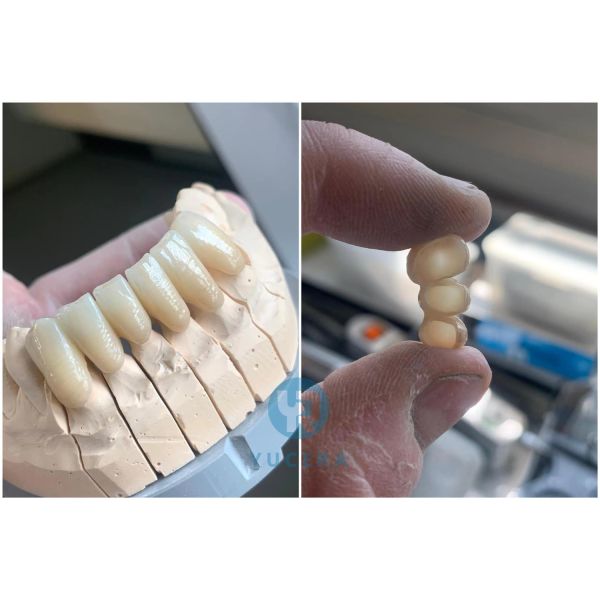 YUCERA 1200MPa 98 HT Dental Zirconia Blocks Dental Consumable Pre Shaded Zirconia Dental Zirconia  Block