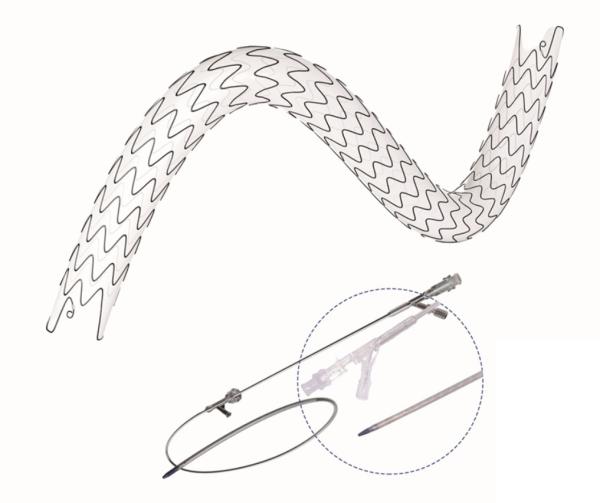 Maximized Lumen URS Stent With Hydrophobic Nitinol Technology Anti Embedding Coating