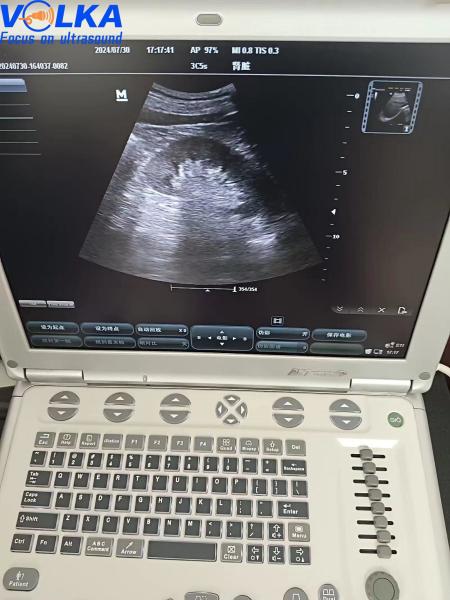 Sistema portátil de ultra-som original Mindray M7