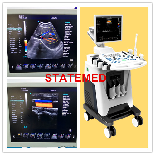 96 E 3d Ultrasound Equipment 15 Inch Monitor / 4D Medical Ultrasound Machine