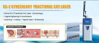 10600nm Fractional CO2 medical Laser of dermatology doctor used for scar removal