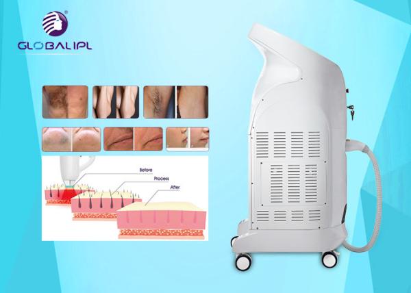 Permanent Ladies Hair Removal Machine 808nm Wavelength For Long Time Working