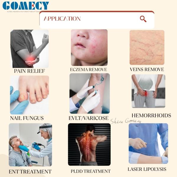 Sistema láser de diodo Gomecy más reciente de 980 nm, 1470 nm y 635 nm para tratamientos de endolifting, cicatrización de heridas y antiinflamatorios